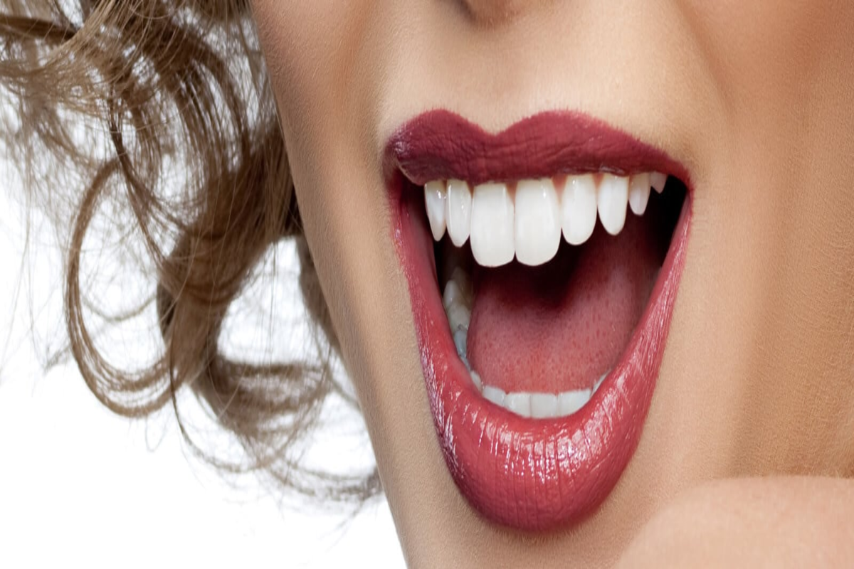 Find Out What A Professional Has To Say On The Teeth Whitening