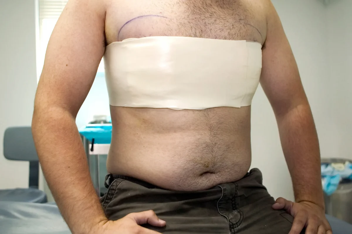 Details About Gynecomastia Surgery